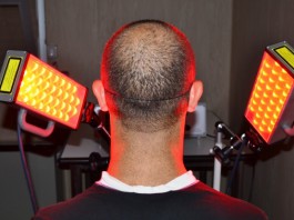 TERAPIA FOTODINAMICA: UNA RISORSA PER IL TRATTAMENTO E LA CURA DEI TUMORI CUTANEI