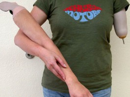 LE RUBANO IL BRACCIO ARTIFICIALE : APPELLO DI UNA DONNA DI CAPO D’ORLANDO “RESTITUITEMELO”