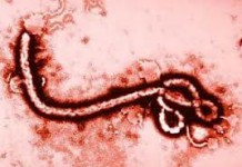 EBOLA: DA CAMBIAMO MESSINA DAL BASSO UN PARERE MEDICO