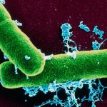 Allarme carbonchio tra le province di Messina e Catania