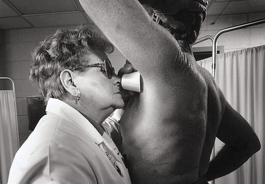 Caso nazionale al Policlinico di Messina: italiani divisi tra il medico igienista e il diritto alle ascelle pezzate