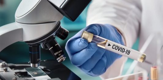 Coronavirus: In Sicilia 85 nuovi casi su 3500 tamponi. Aumentano i ricoveri, 2ue decessi, 7 i guariti