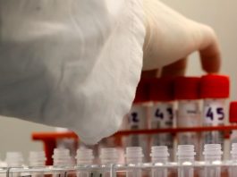 Covid: in netto calo i contagi in Sicilia, processati meno tamponi