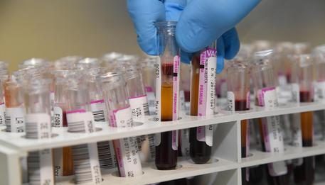 Coronavirus: Sicilia, 156 contagiati nelle ultime 24 ore