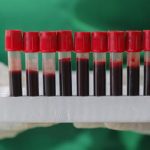 Coronavirus: Razza,ci aspettiamo aumento contagi