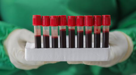 COVID-19 testing amid coronavirus pandemic in Sri Lanka