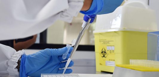 Lipari, 16 positivi e 200 in quarantena precauzionale in attesa di tampone e nuove chiusure
