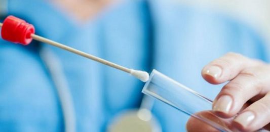 San Fratello: 140 positivi, caos sui tamponi covid