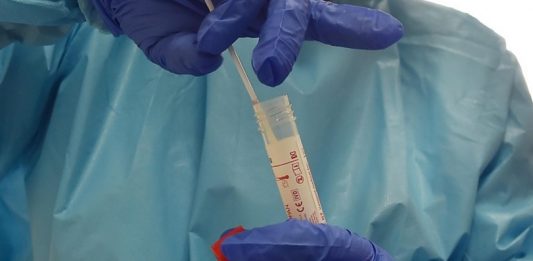 Coronavirus: da domani tamponi rapidi nei drive-in delle maggiori città siciliane
