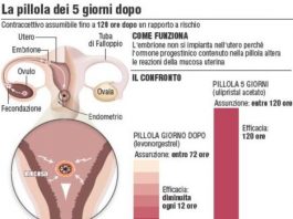 Contraccezione d’emergenza: non serve ricetta anche per le minorenni