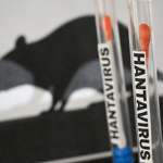 Allarme hantavirus a Messina: solo una polmonite, ma la paura ha viaggiato veloce sui social